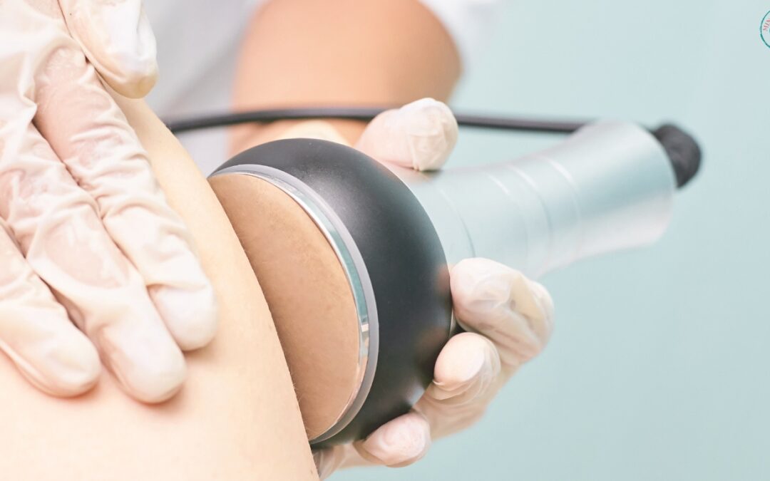 Softwave Therapy: Does It Really Work? | Minetherapy